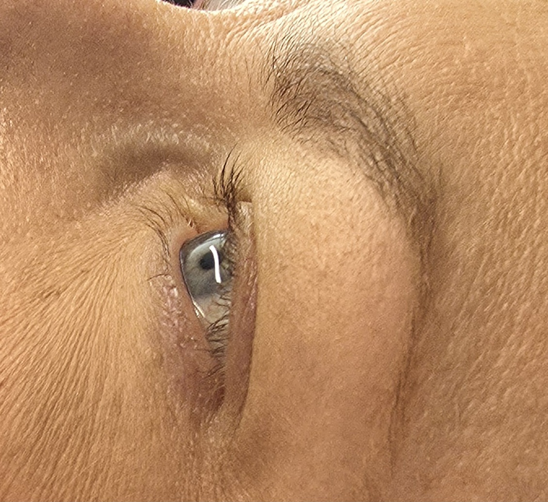 Client's natural lashes before treatment